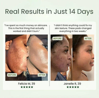 Final 3 Hours: 70%OFF🔥Korean Anti-Aging Toner Pads